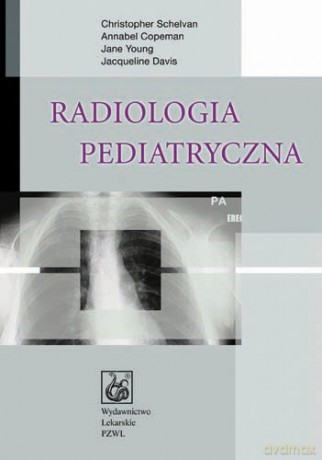 Radiologia pediatryczna - Schelvan [KSIĄŻKA]