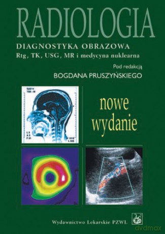 Radiologia - Diagnostyka obrazowa Rtg, TK, USG, MR i medycyna nuklearna - Pruszyński [KSIĄŻKA]