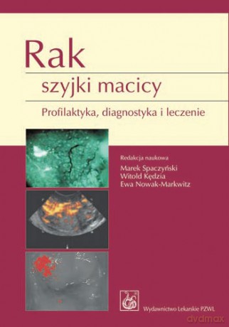 Rak szyjki macicy - Profilaktyka, diagnostyka i leczenie - Spaczyński [KSIĄŻKA]