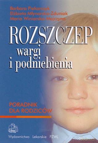 Rozszczep wargi i podniebienia - Poradnik dla rodziców - Piekarczyk [KSIĄŻKA]