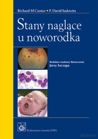 Stany naglące u noworodka - Cantor [KSIĄŻKA]