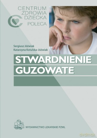Stwardnienie guzowate - Jóźwiak [KSIĄŻKA]