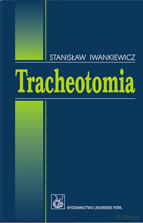 Tracheotomia - Iwankiewicz [KSIĄŻKA]