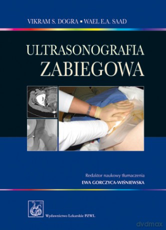 Ultrasonografia zabiegowa - Dogra [KSIĄŻKA]
