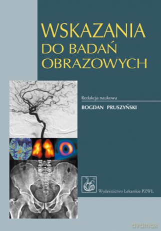 Wskazania do badań obrazowych - Pruszyński [KSIĄŻKA]