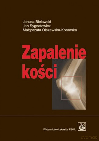 Zapalenie kości - Bielawski [KSIĄŻKA]