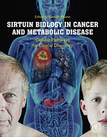 Sirtuin Biology in Cancer and Metabolic Disease: Cellular Pathways for Clinical Discovery - Kenneth Maiese [KSIĄŻKA]