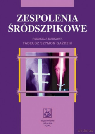Zespolenia śródszpikowe - Gaździk [KSIĄŻKA]