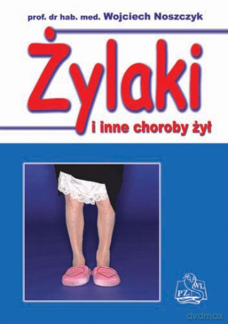 Żylaki i inne choroby żył - Noszczyk [KSIĄŻKA]