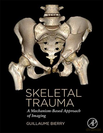 Skeletal Trauma: A Mechanism-Based Approach of Imaging - Guillaume BIERRY [KSIĄŻKA]