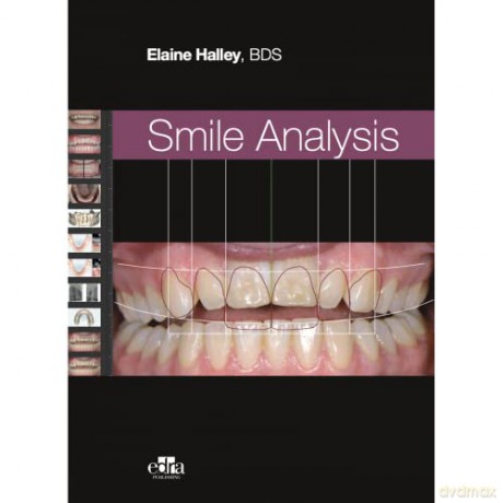 Smile Analysis - BDS Elaine Halley [KSIĄŻKA]