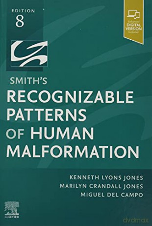 Smith's Recognizable Patterns of Human Malformation: Expert Consult - Online and Print - Kenneth Lyons Jones MD [KSIĄŻKA]