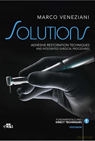 SOLUTIONS - Adhesive restoration techniques restorative and integrated surgical procedures - Marco Veneziani [KSIĄŻKA]