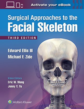Surgical Approaches to the Facial Skeleton [KSIĄŻKA]