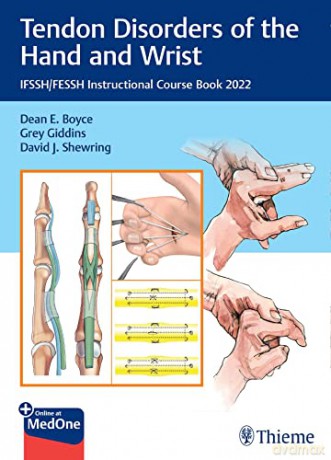 Tendon Disorders of the Hand and Wrist: Ifssh/Fessh Instructional Course Book 2022 - Dean E. Boyce [KSIĄŻKA]