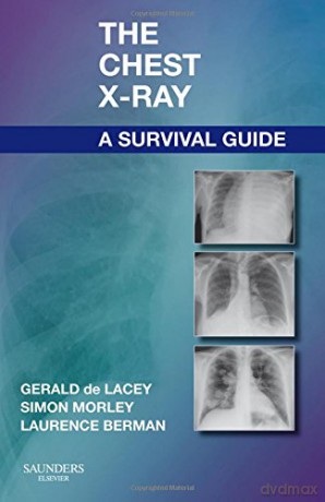The Chest X-Ray Survival Guide - Gerald De Lacey [KSIĄŻKA]