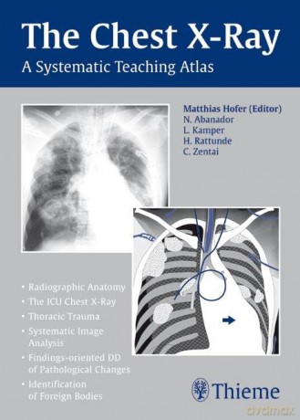 The Chest X-Ray: A Systematic Teaching Atlas - Matthias Hofer [KSIĄŻKA]