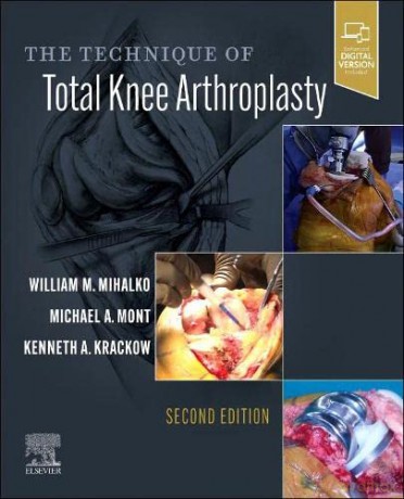 The Technique of Total Knee Arthroplasty - William M. Mihalko MD PhD [KSIĄŻKA]