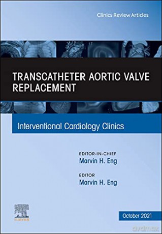 Transcatheter Aortic valve replacement, An Issue of Interventional Cardiology Clinics (Volume 10-4) (The Clinics: Internal Medicine, Volume 10-4) - Marvin H. Eng MD [KSIĄŻKA]