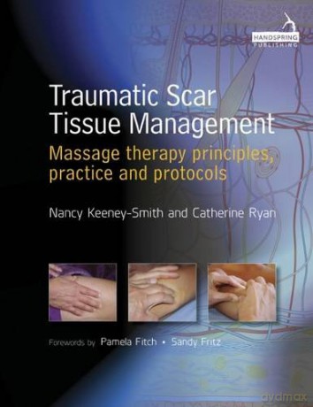 Traumatic Scar Tissue Management: Principles and Practice for Manual Therapy - Nancy Keeney Smith [KSIĄŻKA]