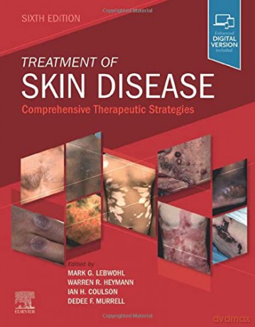 Treatment of Skin Disease: Comprehensive Therapeutic Strategies - Mark G. Lebwohl MD FAAD [KSIĄŻKA]