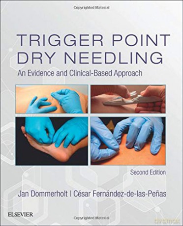 Trigger Point Dry Needling: An Evidence and Clinical-Based Approach, 2e - Jan Dommerholt PT DPT MPS [KSIĄŻKA]