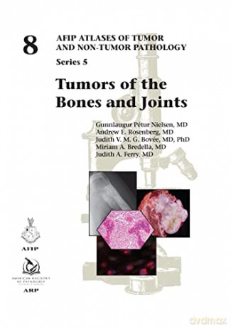 Tumors of the Bones and Joints (AFIP Atlases of Tumor and Non-tumor Pathology, Series 5) - Gunnlaugur Pétur Nielsen [KSIĄŻKA]