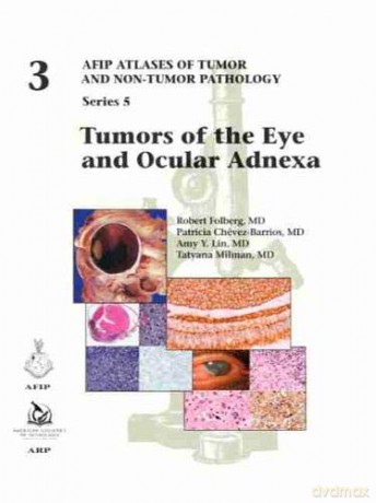Tumors of the Eye and Ocular Adnexa (AFIP Atlas of Tumor and Non-Tumor Pathology, Series 5) - Robert Folberg [KSIĄŻKA]