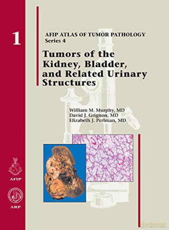 Tumors of the Kidney, Bladder, and Related Urinary Structures (AFIP Atlas of Tumor Pathology, Series 4,) - William M. Murphy [KSIĄŻKA]