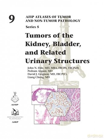 Tumors of the Kidney, Bladder, and Related Urinary Structures (AFIP Atlases of Tumor and Non-tumor Pathology, Series 5) - John Eble [KSIĄŻKA]