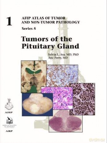 Tumors of the Pituitary Gland (AFIP Atlas of Tumor and Non-Tumor Pathology, Series 5) - Sylvia L. Asa [KSIĄŻKA]