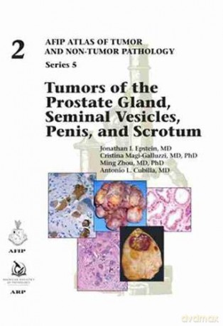 Tumors of the Prostate Gland, Seminal Vesicles, Penis, and Scrotum (AFIP Atlas of Tumor and Non-Tumor Pathology, Series 5) - Jonathan I. Epstein [KSIĄŻKA]