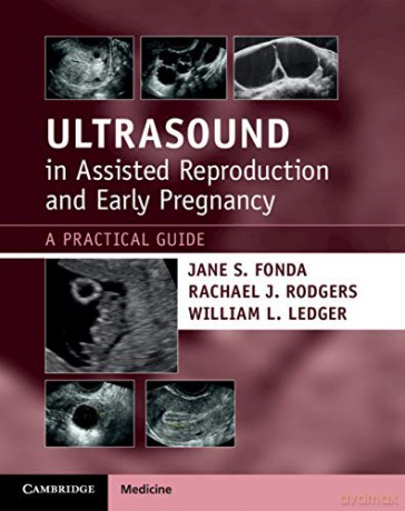 Ultrasound in Assisted Reproduction and Early Pregnancy: A Practical Guide - William L. Ledger [KSIĄŻKA]