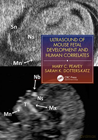 Ultrasound of Mouse Fetal Development and Human Correlates (Reproductive Medicine and Assisted Reproductive Techniques Series) - Mary C. Peavey [KSIĄŻKA]