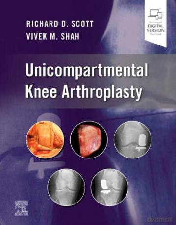 Unicompartmental Knee Arthroplasty - Richard D. Scott [KSIĄŻKA]