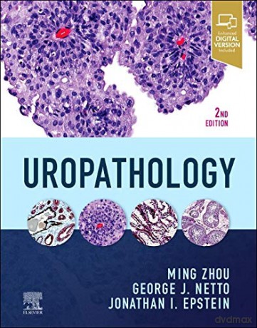 Uropathology - Jonathan I Epstein [KSIĄŻKA]
