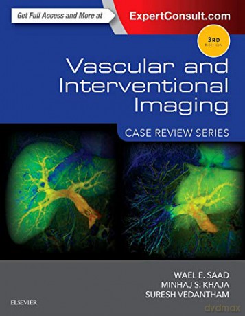 Vascular and Interventional Imaging: Case Review Series, 3e - Wael E. Saad MBBCh FSIR [KSIĄŻKA]