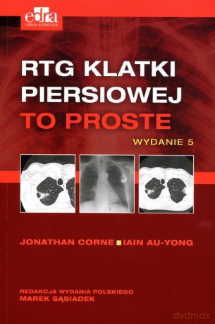 RTG klatki piersiowej To proste - I Au-Jong, J. Corne [KSIĄŻKA]