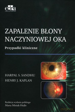 Zapalenie błony naczyniowej oka - H.S. Sandhu, H.J. Kaplan [KSIĄŻKA]