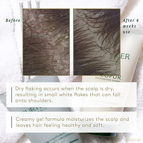 René Furterer (Oily Scalp Dandruff Shampoo) - Volume: 150 ml