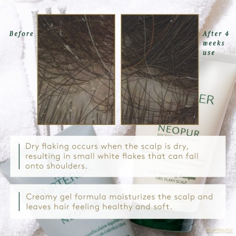 René Furterer (Shampoo Dry Dandruff) - Volume: 150 ml
