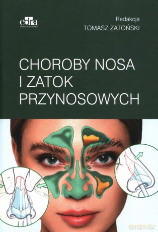 Choroby nosa i zatok przynosowych [KSIĄŻKA]