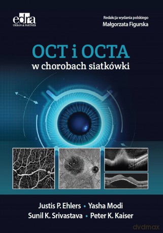 OCT i OCTA w chorobach siatkówki - J.P. Ehlers [KSIĄŻKA]