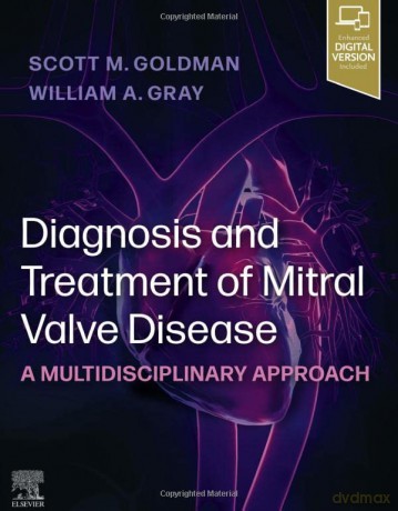 Diagnosis and Treatment of Mitral Valve Disease: A Multidisciplinary Approach - Scott Goldman MD [KSIĄŻKA]