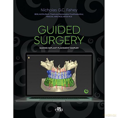 Guided Surgery - Nicholas G.C. Fahey [KSIĄŻKA]