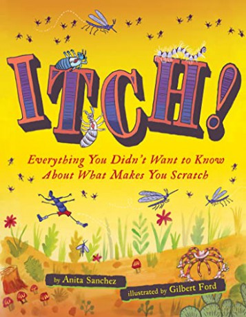 Itch!: Everything You Didn't Want to Know About What Makes You Scratch - Anita Sanchez [KSIĄŻKA]