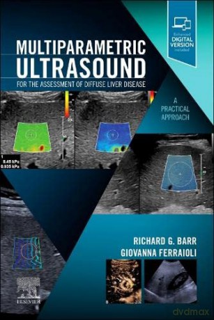 Multiparametric Ultrasound for the Assessment of Diffuse Liver Disease: A Practical Approach - Richard G. Barr MD PhD FACR FAIUM FSRU [KSIĄŻKA]