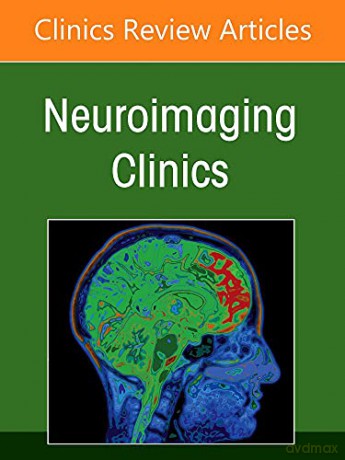 Neuroimaging Anatomy, Part 2: Head, Neck, and Spine, An Issue of Neuroimaging Clinics of North America - Tarik F. Massoud MD PhD [KSIĄŻKA]