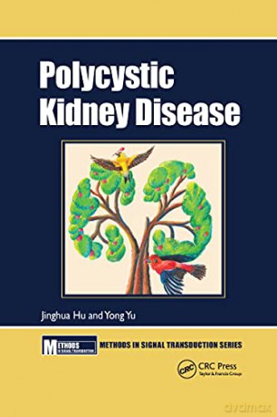 Polycystic Kidney Disease - Jinghua Hu [KSIĄŻKA]