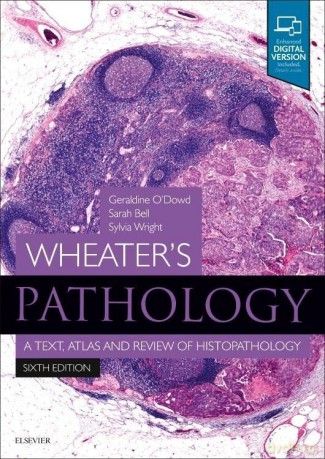Wheater's Pathology: A Text, Atlas and Review of Histopathology, 6e: With STUDENT CONSULT Online Access - Geraldine O'Dowd BSc (Hons) MBChB (Hons) FRCPath [KSIĄŻKA]